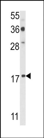 PDRG1 Antibody in Western Blot (WB)