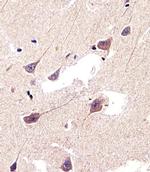 CBS Antibody in Immunohistochemistry (IHC)