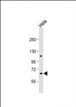 CBS Antibody in Western Blot (WB)