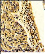 FPGS Antibody in Immunohistochemistry (IHC)