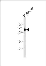 FPGS Antibody in Western Blot (WB)