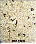 FTO Antibody in Immunohistochemistry (IHC)