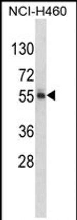 FTO Antibody in Western Blot (WB)