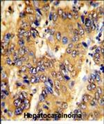 MSRB2 Antibody in Immunohistochemistry (IHC)