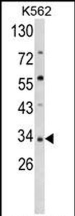 SFRP5 Antibody in Western Blot (WB)