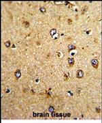 HOMER3 Antibody in Immunohistochemistry (IHC)