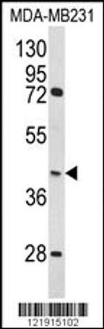 HOMER3 Antibody in Western Blot (WB)