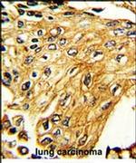 IFNGR2 Antibody in Immunohistochemistry (IHC)