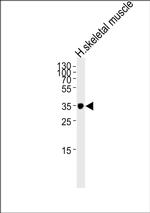IFNGR2 Antibody in Western Blot (WB)
