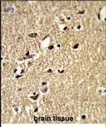 TSHZ1 Antibody in Immunohistochemistry (IHC)