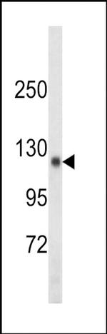 TSHZ1 Antibody in Western Blot (WB)