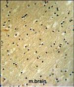 BCOR Polyclonal Antibody