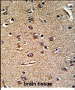 GGT5 Antibody in Immunohistochemistry (IHC)