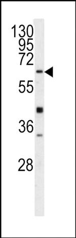 GGT5 Antibody in Western Blot (WB)