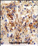 CYP2J2 Antibody in Immunohistochemistry (IHC)