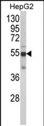 CYP2J2 Antibody in Western Blot (WB)