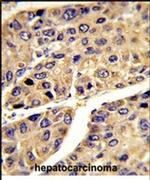 ALS Antibody in Immunohistochemistry (IHC)