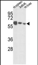 ALS Antibody in Western Blot (WB)
