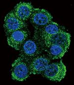 FKBP1B Polyclonal Antibody