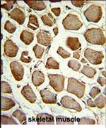 PLEKHO1 Antibody in Immunohistochemistry (IHC)