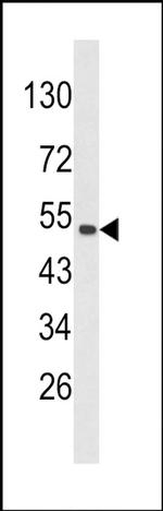 PLEKHO1 Antibody in Western Blot (WB)