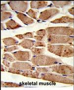RANBP9 Antibody in Immunohistochemistry (IHC)