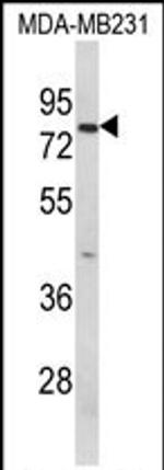 RANBP9 Antibody in Western Blot (WB)