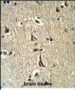GPD1 Antibody in Immunohistochemistry (IHC)