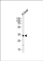 GPD1 Antibody in Western Blot (WB)
