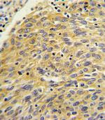 PLA2G4A Antibody in Immunohistochemistry (IHC)