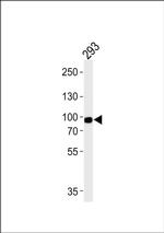 PLA2G4A Antibody in Western Blot (WB)