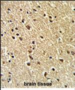 ZNF823 Antibody in Immunohistochemistry (IHC)