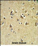 VPS53 Antibody in Immunohistochemistry (IHC)