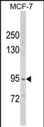 VPS53 Antibody in Western Blot (WB)