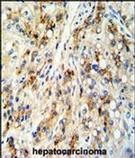 CECR5 Antibody in Immunohistochemistry (IHC)