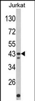 CECR5 Antibody in Western Blot (WB)