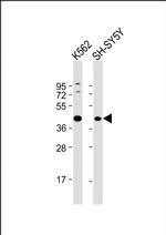 ADH5 Antibody in Western Blot (WB)