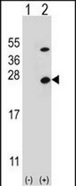 ATP Synthase O Antibody in Western Blot (WB)