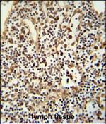 ANO5 Polyclonal Antibody