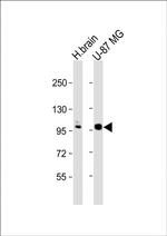 ANO5 Antibody in Western Blot (WB)