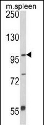 ANO5 Antibody in Western Blot (WB)