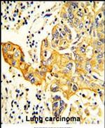 RARS2 Antibody in Immunohistochemistry (IHC)