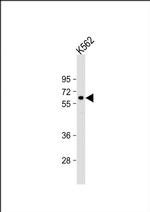 RARS2 Antibody in Western Blot (WB)