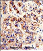 PON3 Antibody in Immunohistochemistry (IHC)