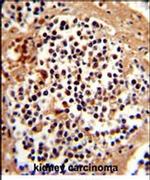 SERPINB7 Antibody in Immunohistochemistry (IHC)