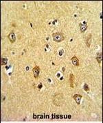 PPP2R2B Polyclonal Antibody