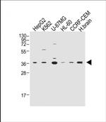 MPZ Antibody in Western Blot (WB)