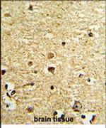 OLIG3 Antibody in Immunohistochemistry (IHC)