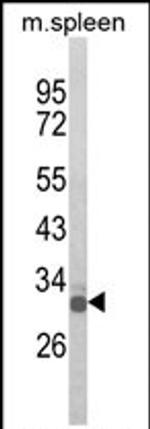 OLIG3 Antibody in Western Blot (WB)