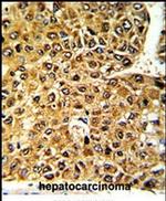 MLX Antibody in Immunohistochemistry (IHC)